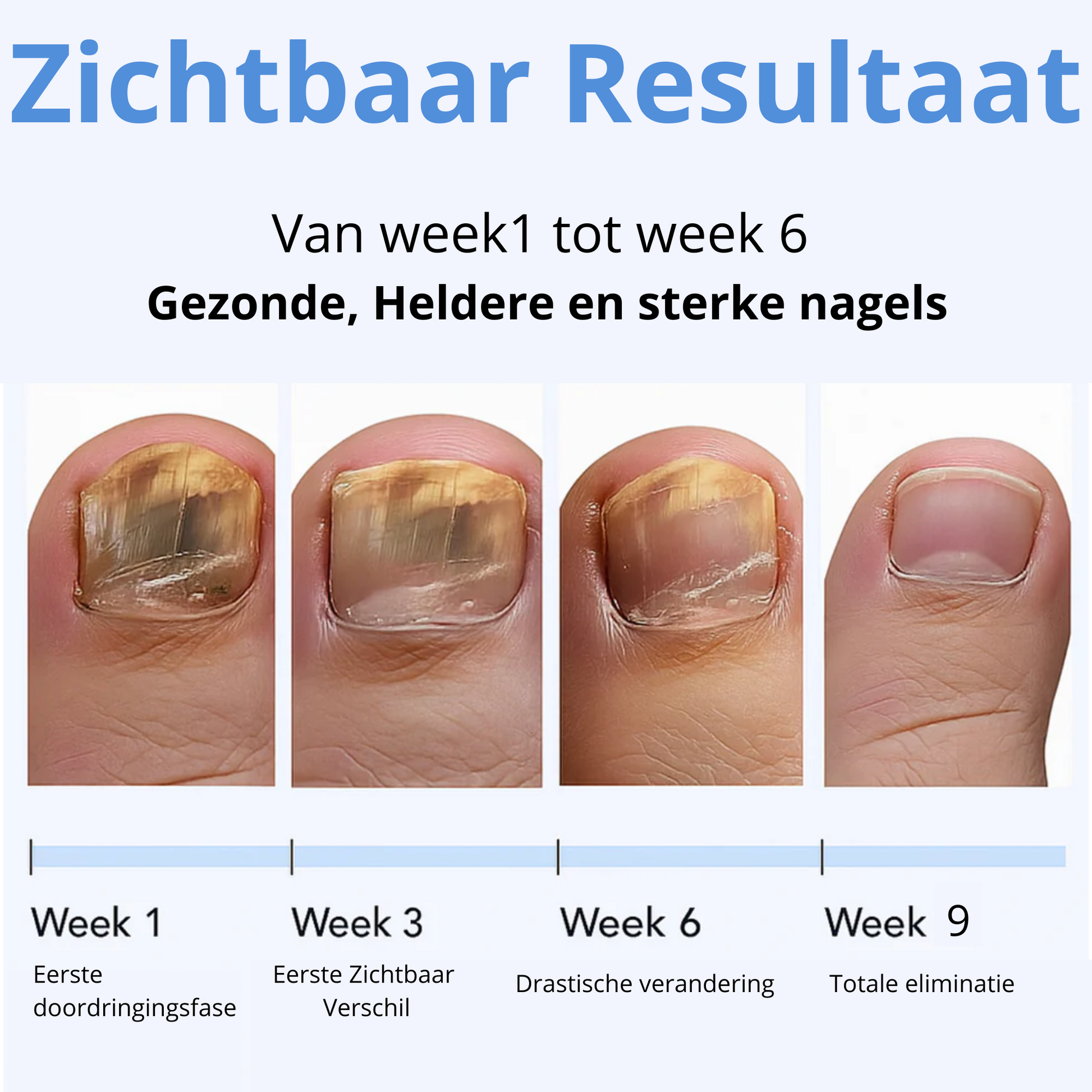 VootoxFix™ |  Schimmelnagel-herstelpleisters